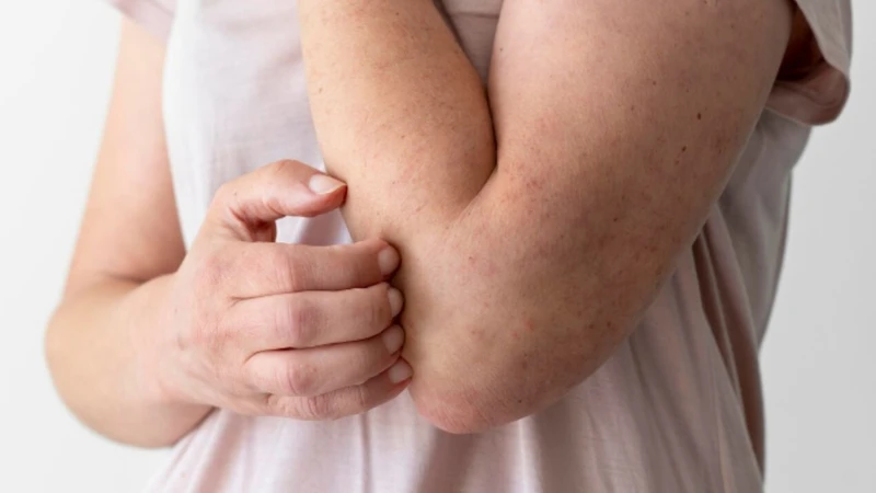 5 cách trị vết thâm muỗi đốt lâu ngày cho bé​ 2