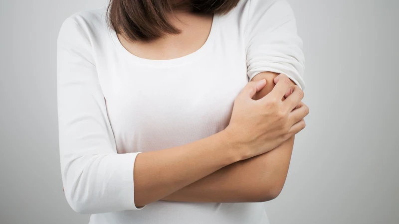 Ngứa toàn thân là bệnh gì? Cảm giác ngứa toàn thân do nguyên nhân nào gây ra? 2