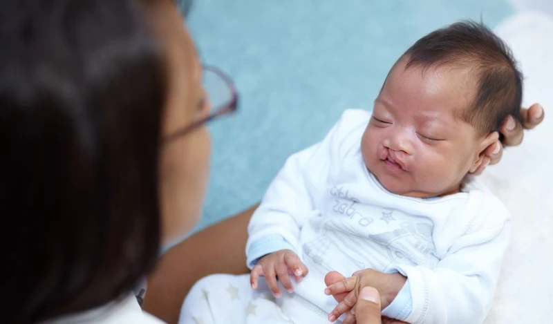 Người mắc dị tật bẩm sinh như hở hàm ếch nên xét nghiệm gen trước khi mang thai