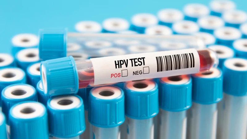 Xét nghiệm HPV nam giới ở đâu? Gợi ý những địa chỉ xét nghiệm HPV uy tín 1