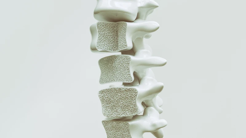 Xét nghiệm mật độ xương giúp phát hiện sớm tình trạng loãng xương.