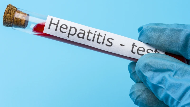 Anti-HBs là gì? Chỉ số Anti-HBs bao nhiêu là bình thường?
