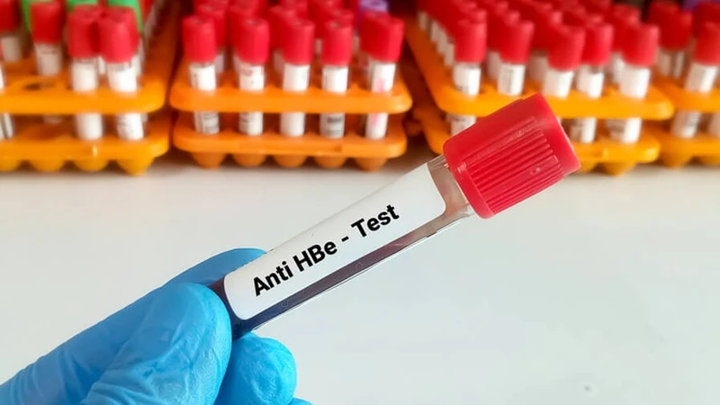 Anti-HBe là kháng thể e của virus&nbsp;viêm gan B