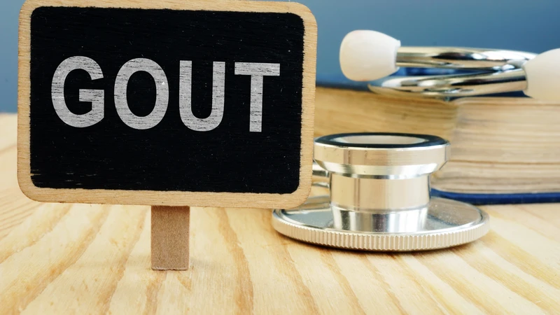 Tình trạng gout và tăng axit uric đang có xu hướng gia tăng cùng với lối sống đô thị hóa, chế độ ăn nhiều đạm và ít vận động