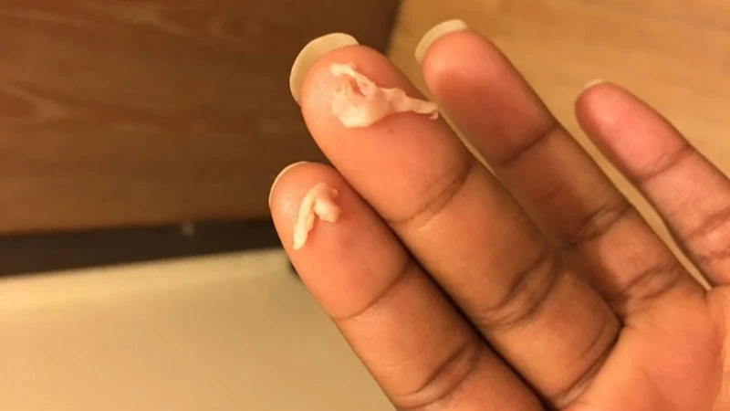 Bà bầu ra khí hư màu trắng sữa không ngứa là dấu hiệu sinh lý hay cảnh báo bất thường? 1