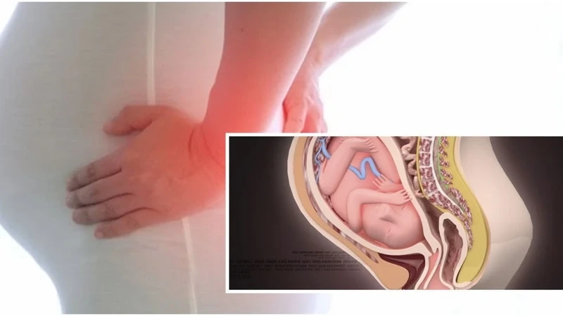 Bà bầu ra khí hư màu trắng sữa không ngứa là dấu hiệu sinh lý hay cảnh báo bất thường? 3