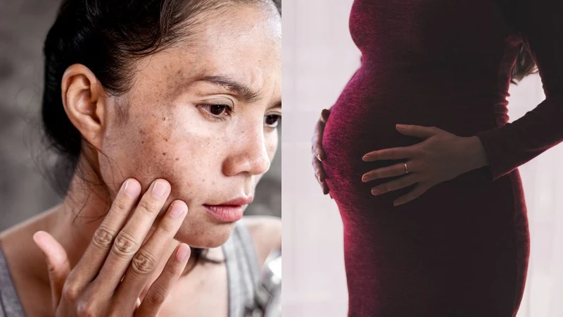 Bầu 23 tuần là mấy tháng? Trạng thái thai phụ lúc này ra sao? 2