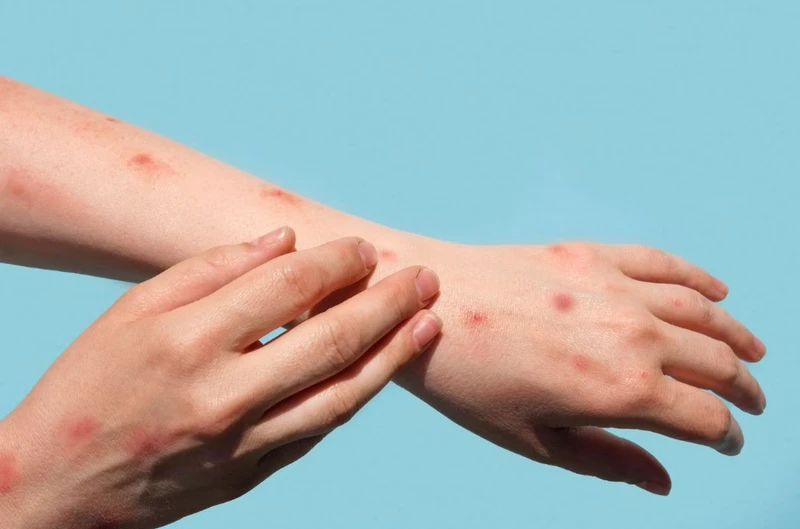 Bầu 7 tháng uống kháng sinh có sao không? Những lưu ý khi sử dụng thuốc kháng sinh cho bà bầu 5