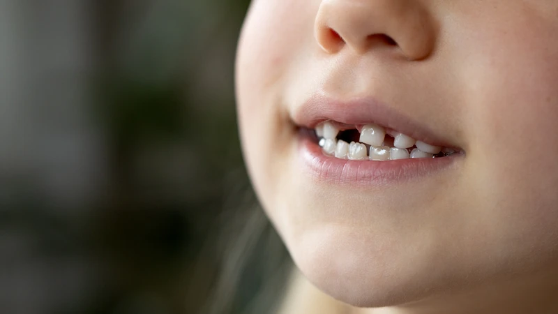 Hiểu đúng quá trình thay răng giúp đánh giá bé 5 tuổi thay răng sữa có sớm không?