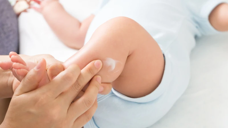 Chăm sóc da đúng cách và giữ môi trường ngủ sạch sẽ giúp giảm cảm giác khó chịu cho trẻ