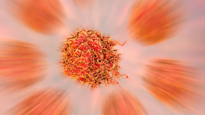 Sùi mào gà là bệnh lý do virus HPV (Human Papillomavirus) gây ra