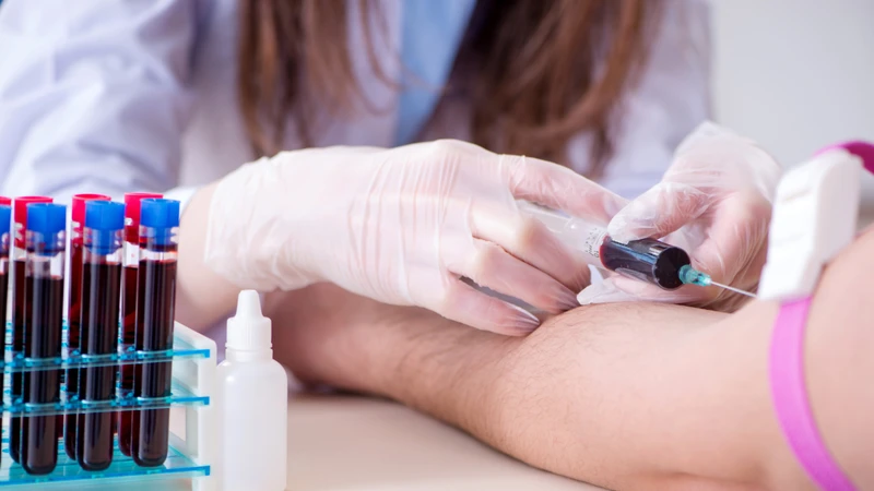 Xét nghiệm máu có thể được chỉ định nhằm tìm kiếm các dấu hiệu của bệnh lý viêm khớp hoặc bệnh tự miễn