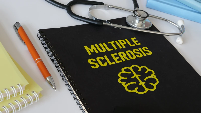 Quản lý tốt bệnh Multiple Sclerosis có thể hạn chế tình trạng đau dây thần kinh số 5