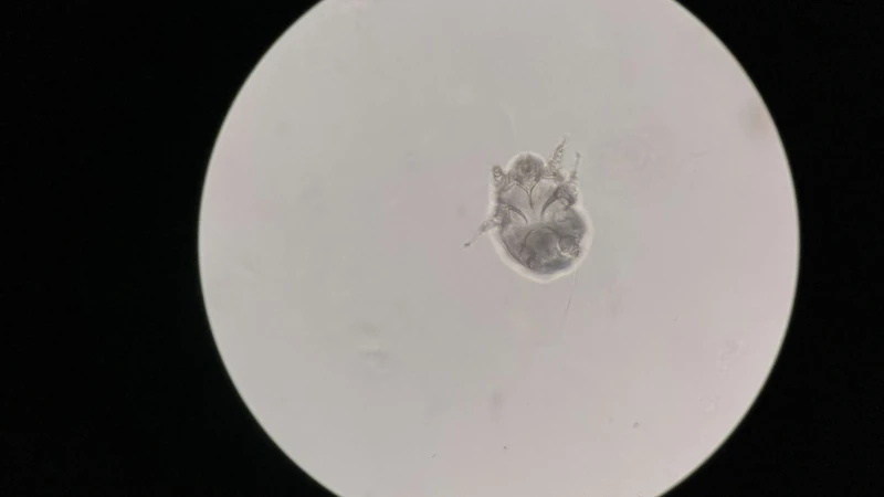 Ký sinh trùng ghẻ Sarcoptes scabiei hominis