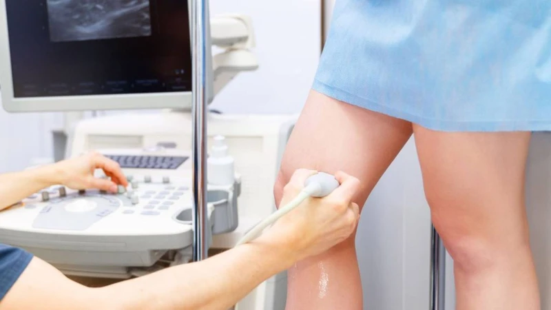 Siêu âm Doppler động tĩnh mạch chi dưới là một trong những phương pháp để chẩn đoán bệnh