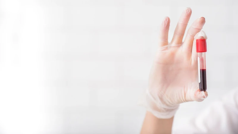 Các xét nghiệm có thể được sử dụng để đánh giá hậu quả của bệnh và nguyên nhân nền