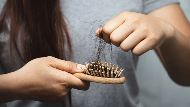 Bệnh có thể gây rụng tóc kéo dài hoặc tái phát