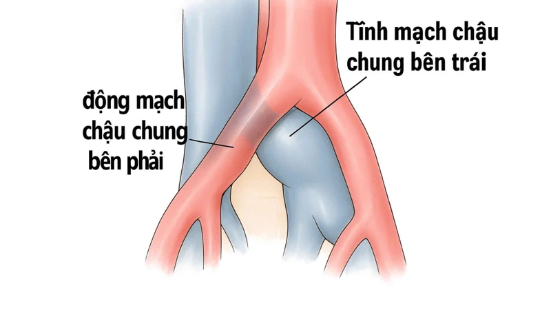 Bất thường cấu trúc giải phẫu là nguyên nhân gây bệnh