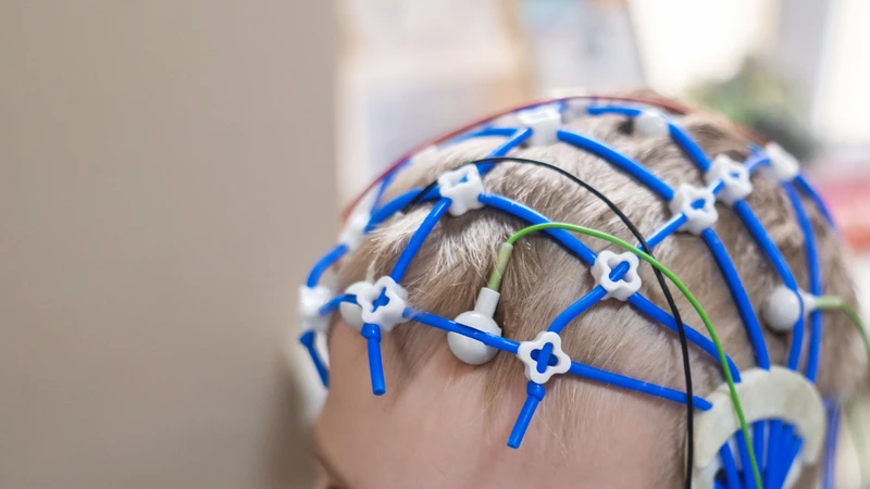 Điện não đồ là phương pháp hỗ trợ quan trọng, đặc biệt ở người bệnh có động kinh hoặc nghi ngờ cơn co giật