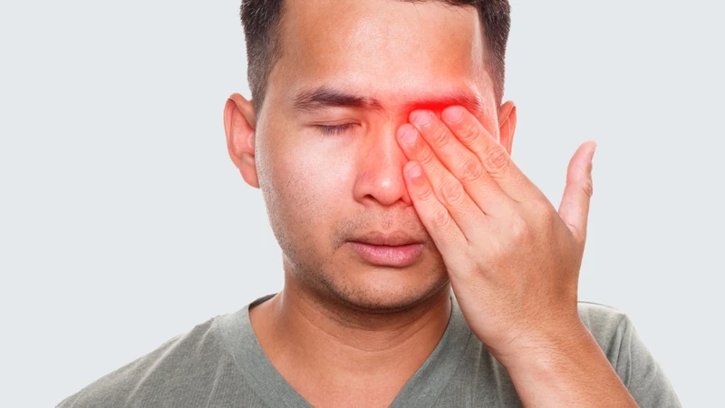 Nguyên nhân chính xác gây hội chứng Tolosa-Hunt hiện chưa được xác định