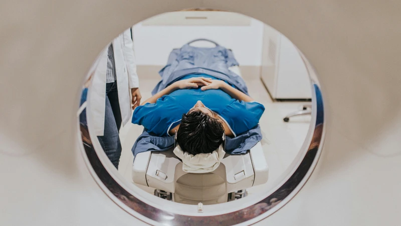 MRI là phương pháp có giá trị cao trong đánh giá cấu trúc não và đường đi của dây thần kinh số III