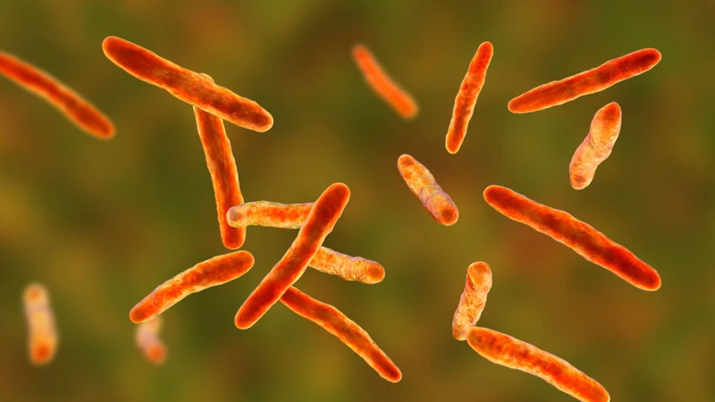 Loét Buruli do vi khuẩn&nbsp;Mycobacterium ulcerans gây ra