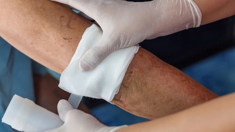 Vệ sinh và xử lý sớm vết thương ngoài da đúng cách để giảm nguy cơ vi khuẩn xâm nhập