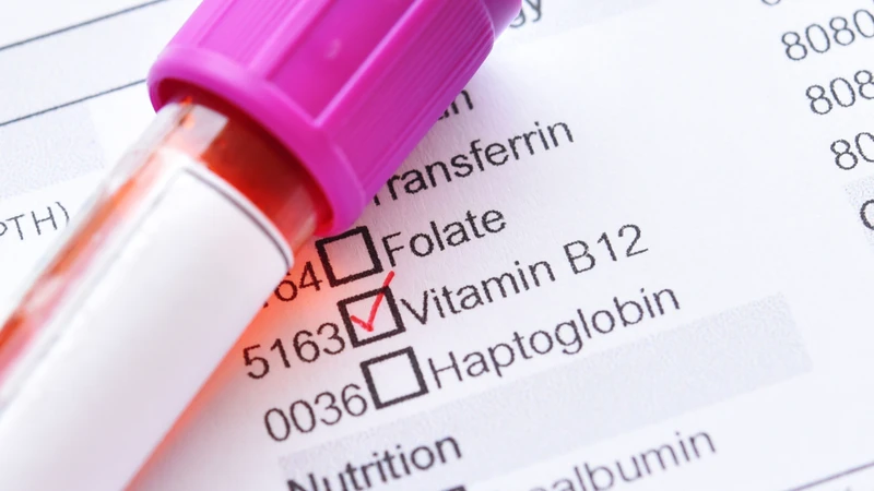 Định lượng vitamin B12 có thể được chỉ định trong trường hợp nghi ngờ thiếu vi chất
