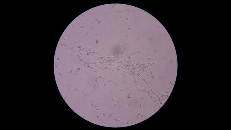 Trichophyton rubrum là một trong những tác nhân phổ biến gây nấm móng