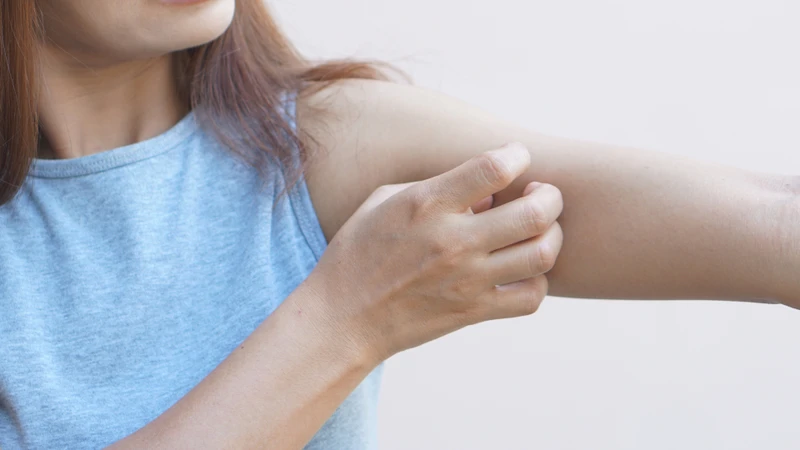 Ngứa là cảm giác khó chịu xảy ra trên da, khiến người bệnh có xu hướng gãi để giảm bớt khó chịu