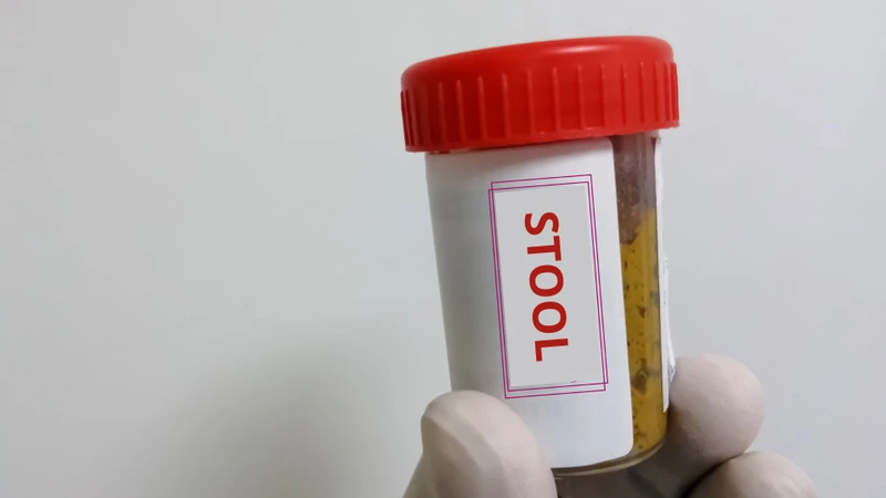 Xét nghiệm phân giúp phát hiện vi khuẩn, virus, ký sinh trùng, bạch cầu hoặc máu ẩn trong phân