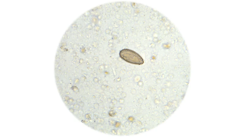 Bệnh sán lá gan nhỏ do các loài sán thuộc nhóm Trematoda gây ra