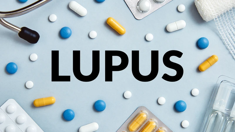 Người mắc bệnh lupus ban đỏ có nguy cơ bị sẩn ngứa cao hơn