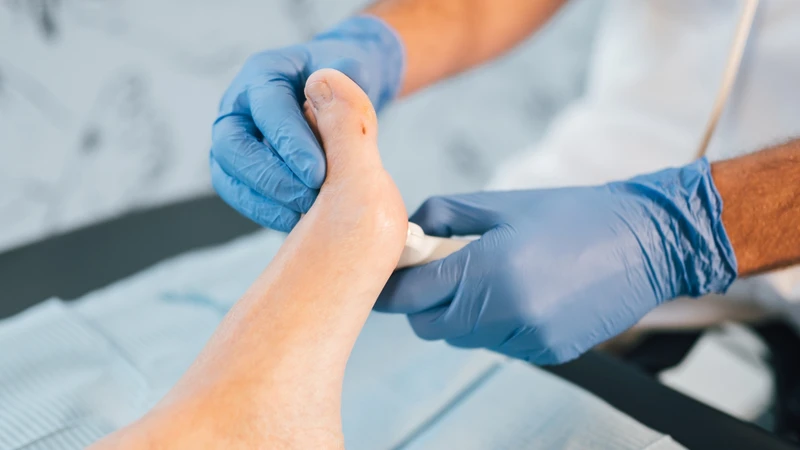 Siêu âm có thể giúp phát hiện tình trạng dày lên của dây thần kinh liên ngón