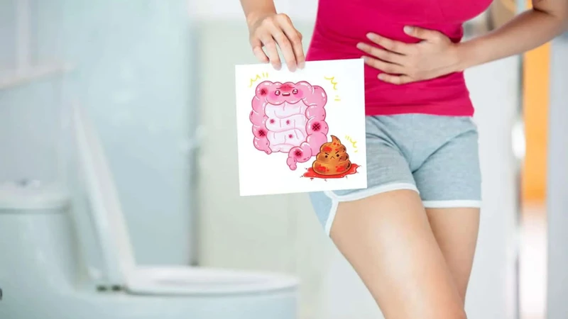 Đi cầu ra máu là một trong những triệu chứng của ung thư trực tràng giai đoạn 3