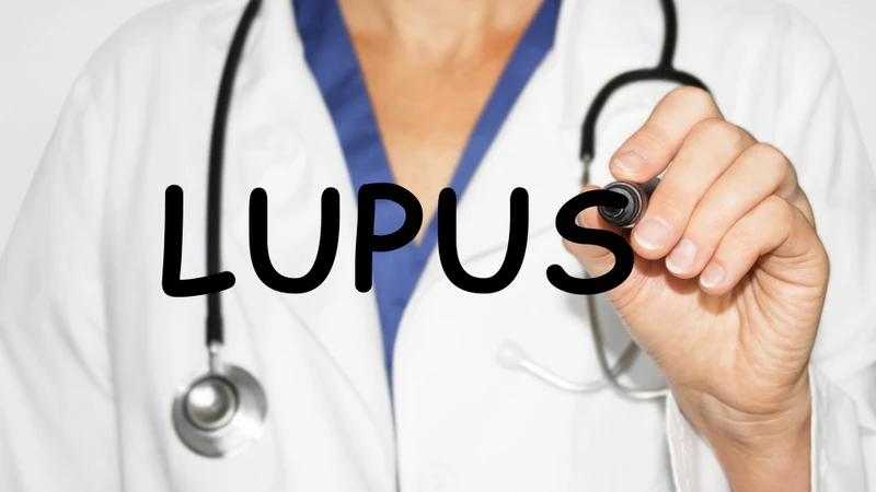 Lupus ban đỏ hệ thống là một trong những bệnh tự miễn có thể gây viêm cầu thận cấp