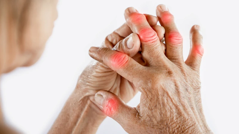 Viêm khớp dạng thấp thường khởi phát ở khớp nhỏ như khớp ngón tay, gây viêm đối xứng và có thể dẫn đến biến dạng nếu không điều trị