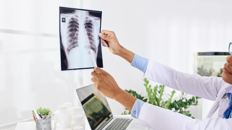 Chụp X-quang ngực có vai trò quan trọng trong việc loại trừ các nguyên nhân khác