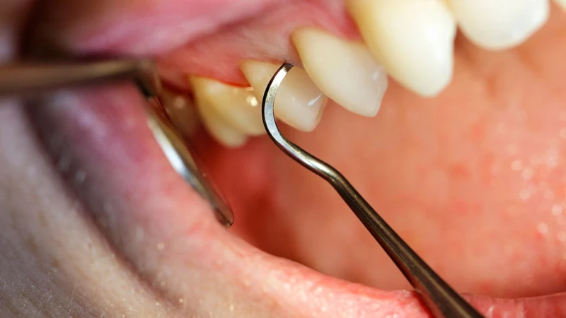Thăm khám lâm sàng giúp bác sĩ khai thác triệu chứng, tiền sử bệnh để đánh giá tình trạng lợi