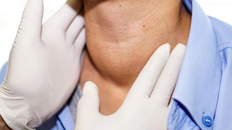 Người bệnh cần tuân thủ điều trị và tái khám đúng hẹn kiểm soát bệnh Basedow hiệu quả
