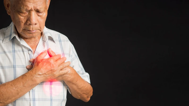 Nhồi máu cơ tim là một bệnh cấp tính nặng có thể gây tử vong