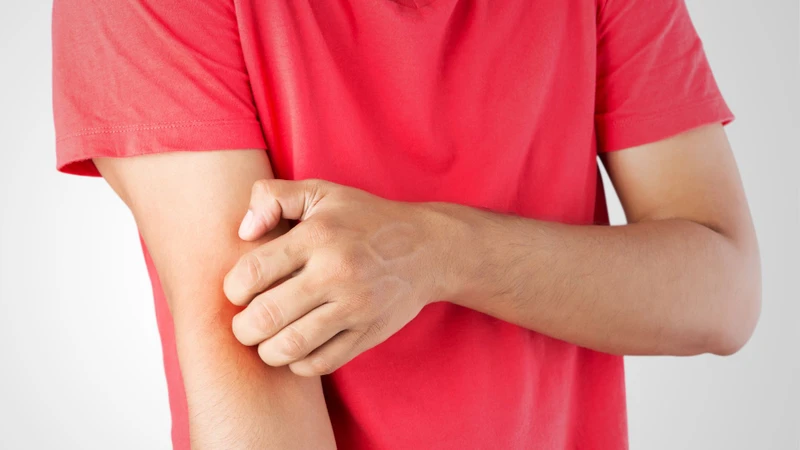Tổn thương hàng rào bảo vệ da tạo điều kiện cho vi khuẩn phát triển