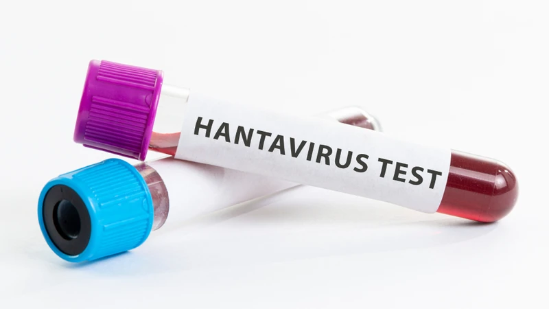 Chuột nhiễm Hantavirus có thể thải virus qua phân, nước tiểu và nước bọt