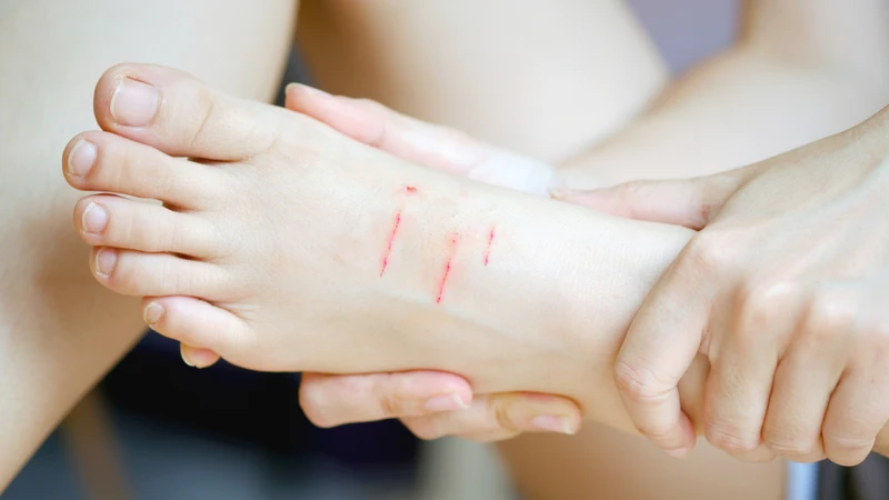 Bệnh dại có lây qua đường máu không? Cách phòng tránh nguy cơ lây nhiễm bệnh dại qua máu 5