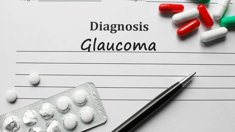 Glocom (Glaucoma) còn được gọi là cườm nước