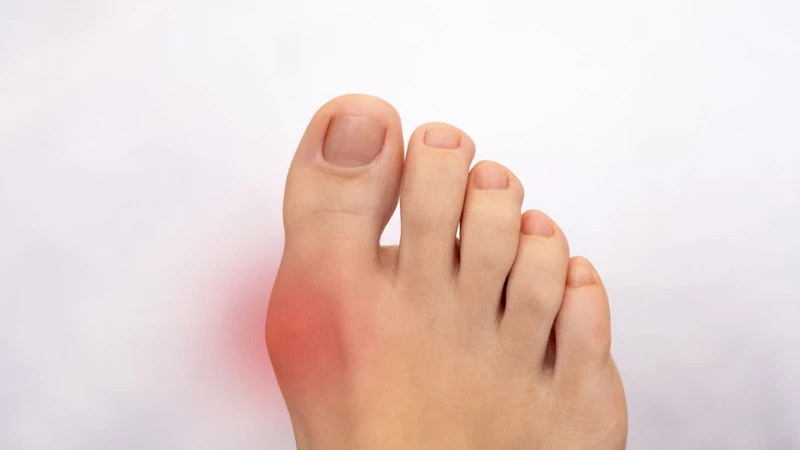 Người bệnh gout không cần kiêng tất cả các loại rau có purin
