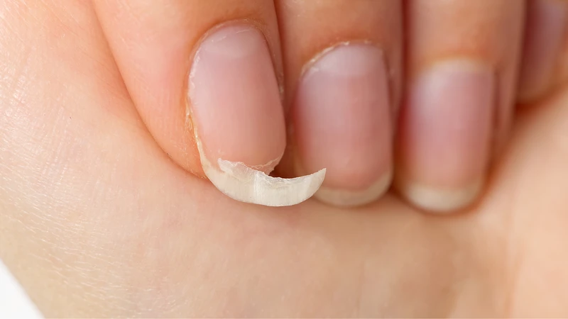 Móng tay yếu, dễ gãy là dấu hiệu thiếu canxi