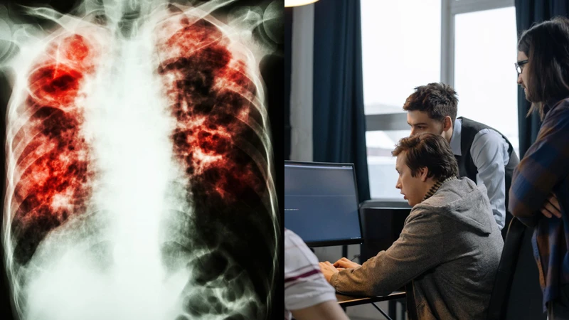 Bệnh lao phổi có đi làm được không? Biện pháp phòng ngừa bệnh hiệu quả 1