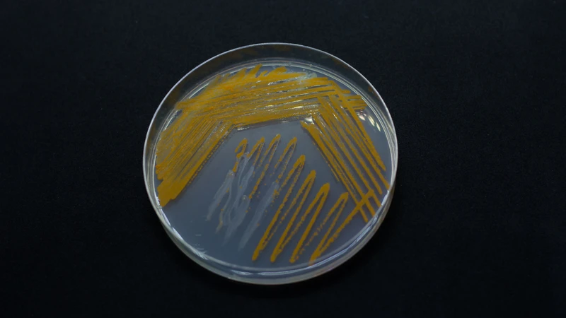 Bệnh nấm Actinomyces israelii do vi khuẩn Actinomyces israelii gây ra