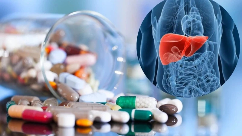Bệnh não gan là gì? Những điều cần biết để phòng tránh 5.jpg